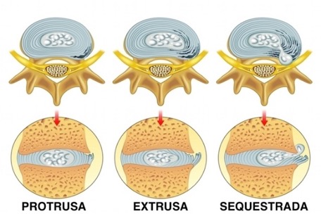 Tratamentos naturais de veias faciais